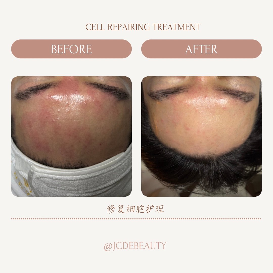 Before and after cell repairing treatment result